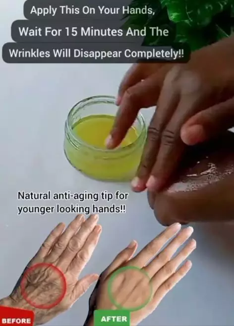 Atasi keriput pada tangan dengan 1 jenis kulit buah Berbagai sumber Atasi keriput pada tangan dengan 1 jenis kulit buah Berbagai sumber
