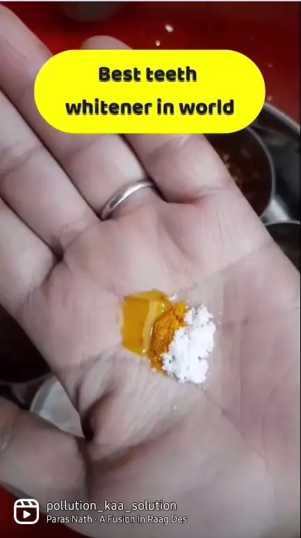 trik hilangkan plak di gigi berbagai sumber