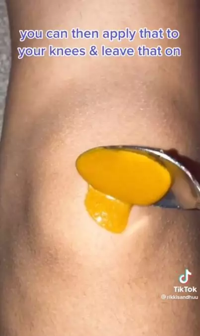 Memutihkan lutut hitam dengan 1 jenis rempah dapur Berbagai sumber