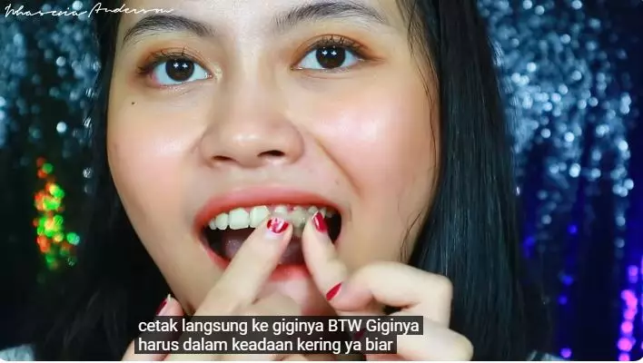 cara membuat gigi gingsul berbagai sumber cara membuat gigi gingsul berbagai sumber