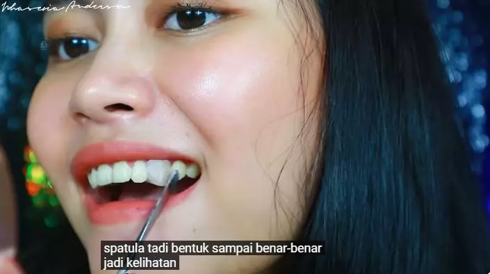 cara membuat gigi gingsul berbagai sumber cara membuat gigi gingsul berbagai sumber