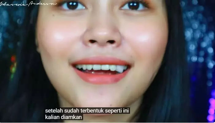 cara membuat gigi gingsul berbagai sumber cara membuat gigi gingsul berbagai sumber