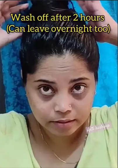 cara atasi rambut pitak berbagai sumber