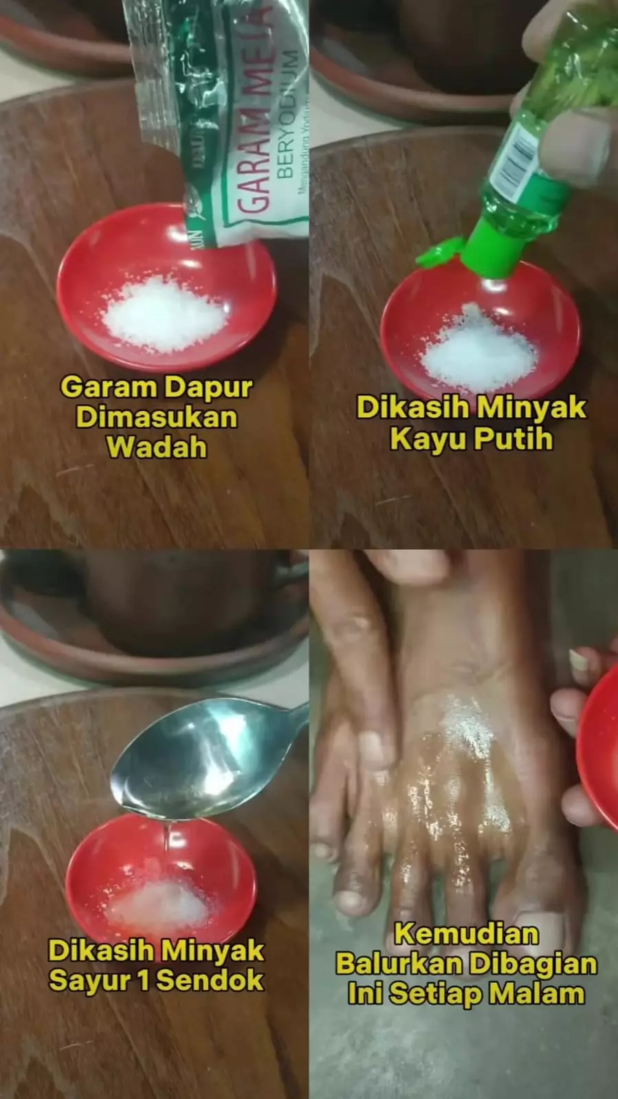 basmi kutu air di sela jari kaki © Instagram basmi kutu air di sela jari kaki © Instagram