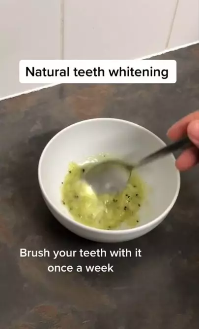 Putihkan gigi penuh plak pakai 2 jenis buah-buahan Berbagai sumber Putihkan gigi penuh plak pakai 2 jenis buah-buahan Berbagai sumber