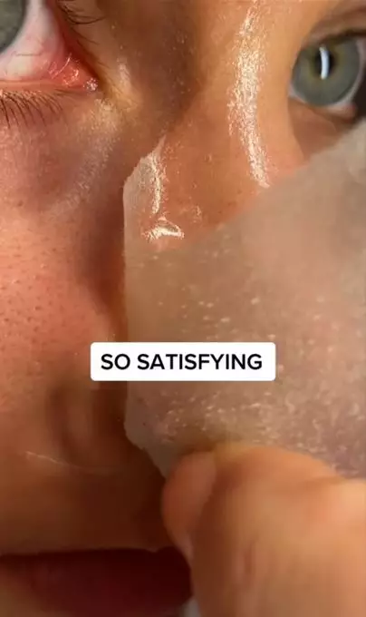 Bersihkan pori-pori tersumbat pakai 1 jenis minuman Berbagai sumber