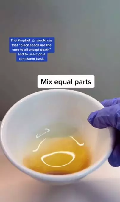 Atasi kebotakan akibat rontok pakai 2 jenis minyak Berbagai sumber