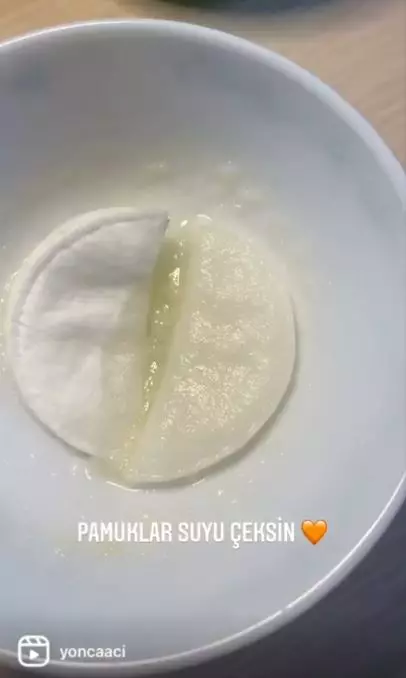 Atasi kentung mata menghitam dengan 1 buah-buahan Berbagai sumber