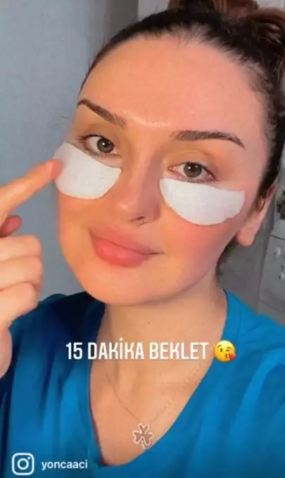 Atasi kentung mata menghitam dengan 1 buah-buahan Berbagai sumber