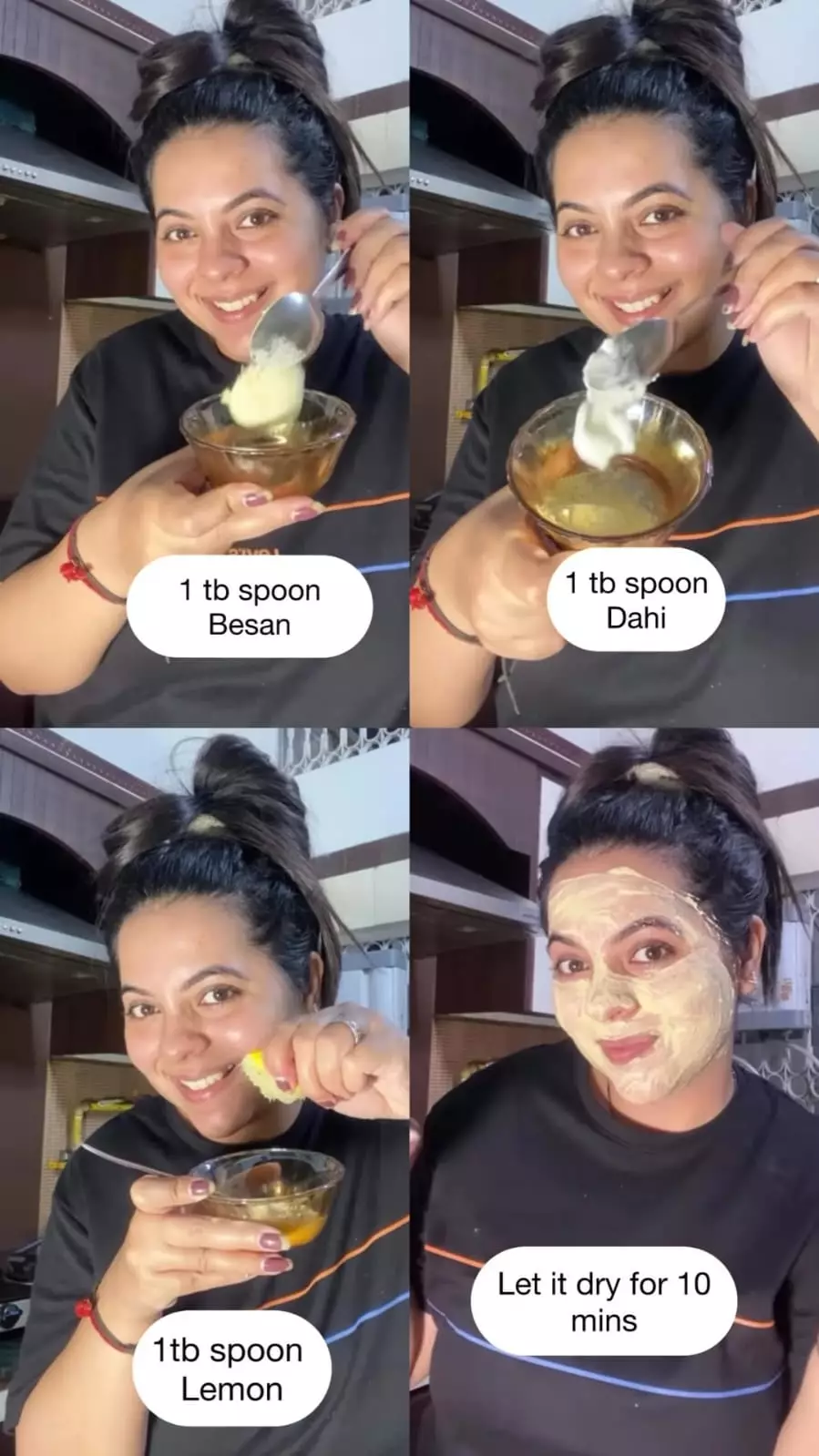 jerawat hormonal berlebih di masa kehamilan © Instagram jerawat hormonal berlebih di masa kehamilan © Instagram