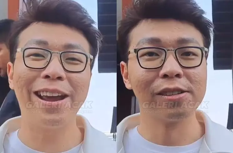 transformasi Richard Lee © Instagram