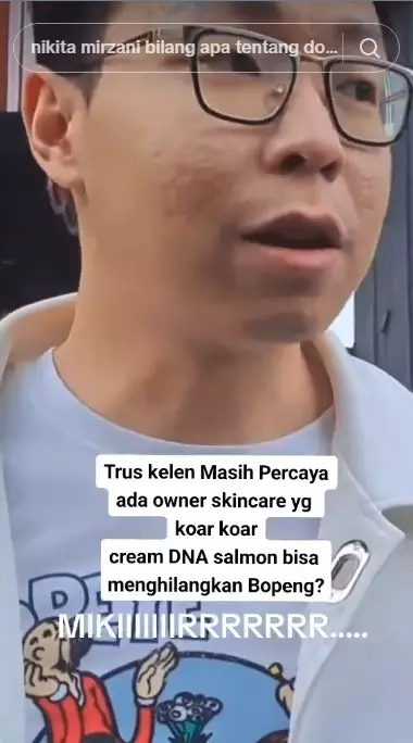 transformasi Richard Lee © Instagram