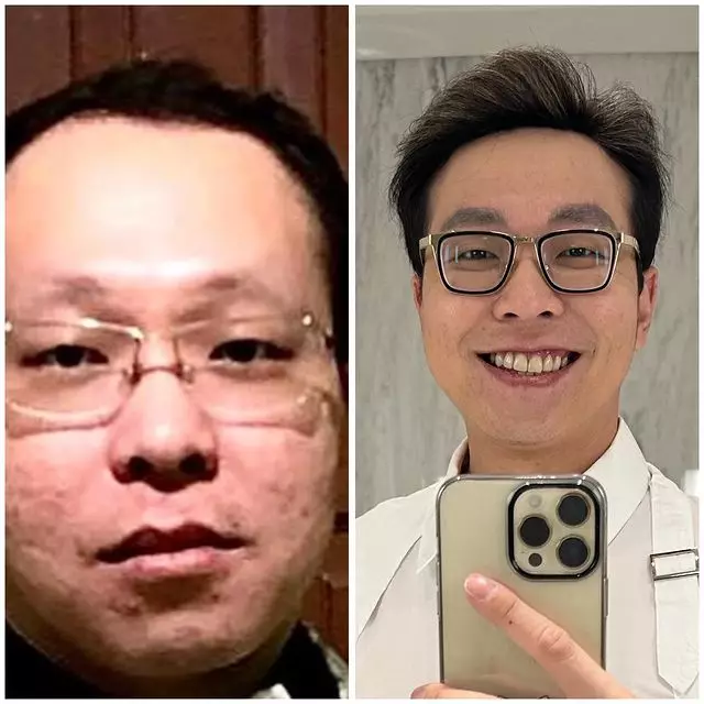 transformasi Richard Lee © Instagram