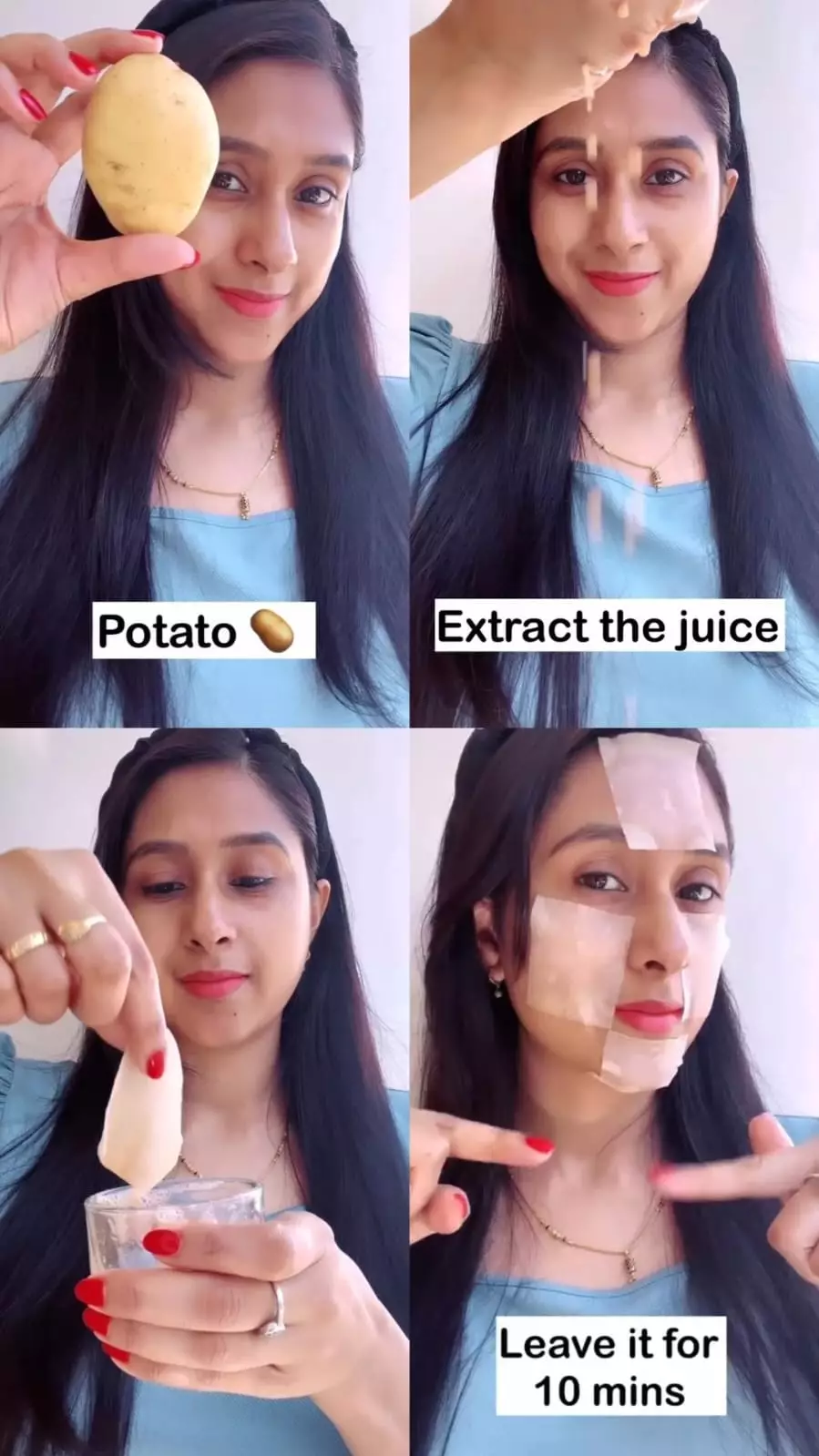 dari noda hitam dan bekas jerawat © Instagram dari noda hitam dan bekas jerawat © Instagram