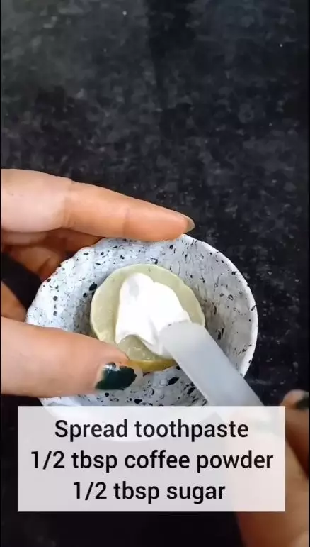 atasi jerawat punggung pakai pasta gigi berbagai sumber