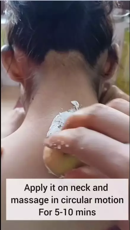 atasi jerawat punggung pakai pasta gigi berbagai sumber