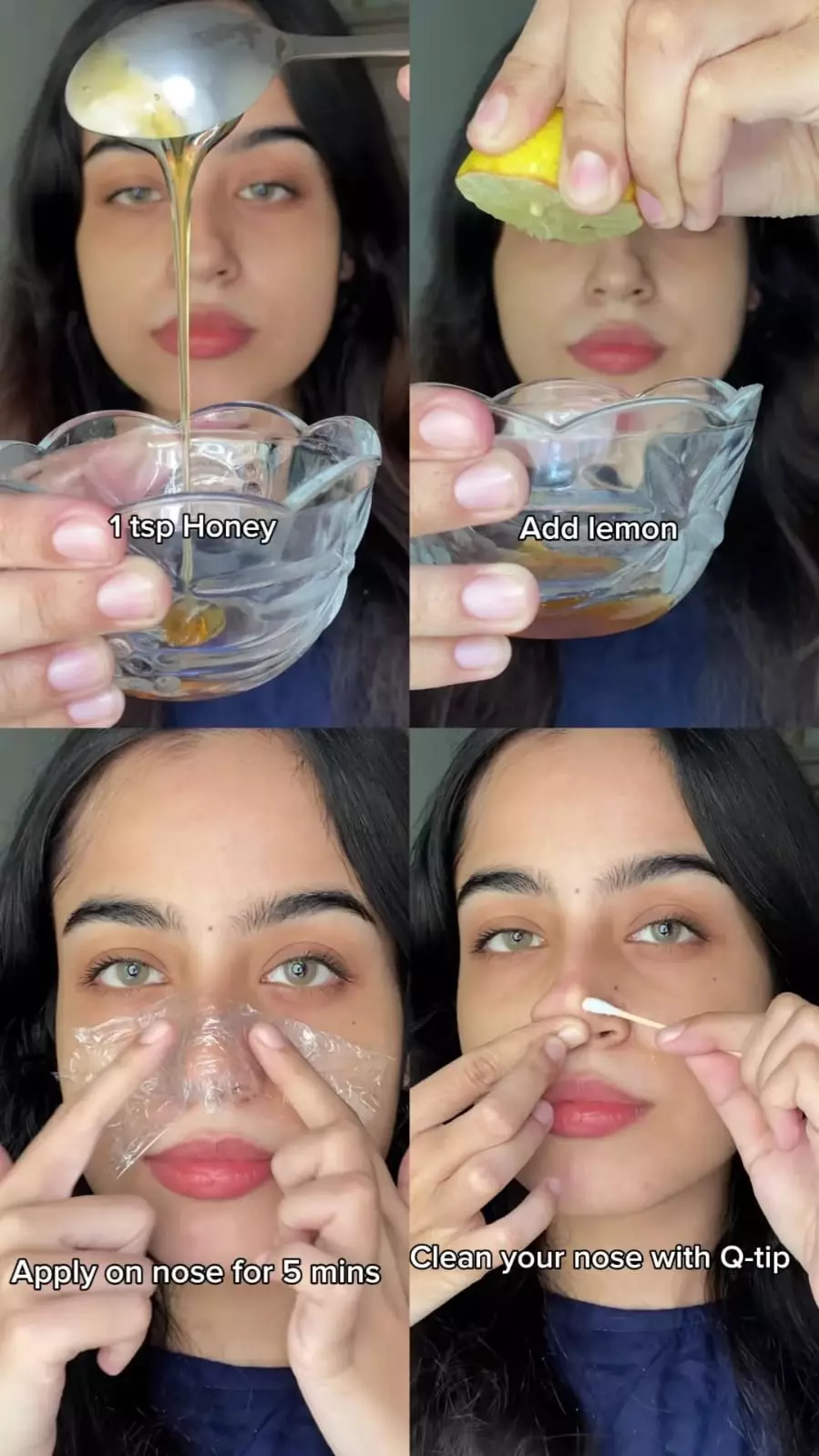 hidung mulus dari komedo tersumbat © Instagram