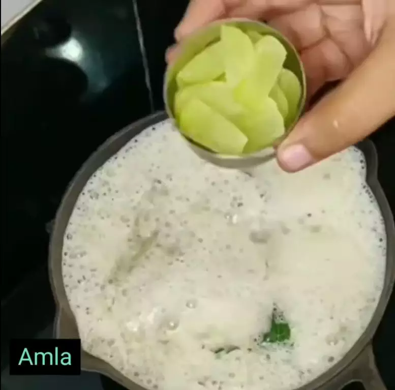 cara menghilangkan ketombe kering berbagai sumber