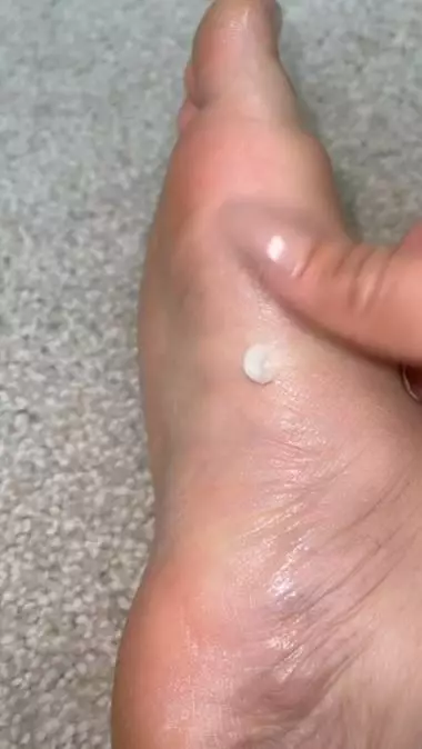 Lembutkan tumit kering dan retak pakai 1 buah-buahan Berbagai sumber