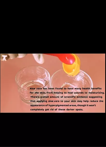 cara kembalikan elastisitas kulit wajah berbagai sumber cara kembalikan elastisitas kulit wajah berbagai sumber