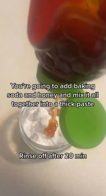 Angkat komedo hitam pada pipi dan hidung pakai 1 bahan kue Berbagai sumber Angkat komedo hitam pada pipi dan hidung pakai 1 bahan kue Berbagai sumber