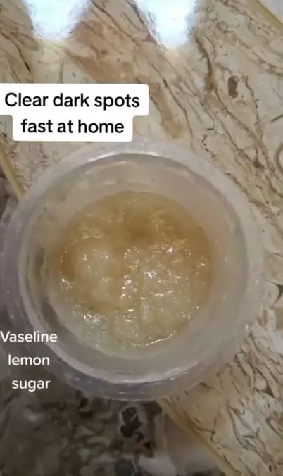 Hilangkan flek hitam pada wajah pakai 1 jenis produk pelembap Berbagai sumber Hilangkan flek hitam pada wajah pakai 1 jenis produk pelembap Berbagai sumber