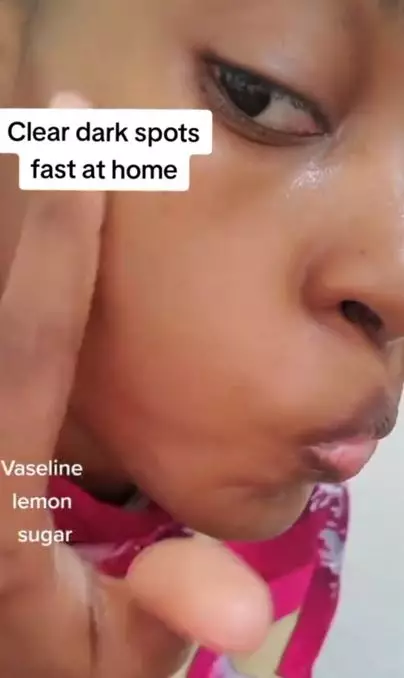 Hilangkan flek hitam pada wajah pakai 1 jenis produk pelembap Berbagai sumber Hilangkan flek hitam pada wajah pakai 1 jenis produk pelembap Berbagai sumber