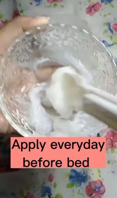 Haluskan tumit retak dengan tambahan 1 buah-buahan Berbagai sumber