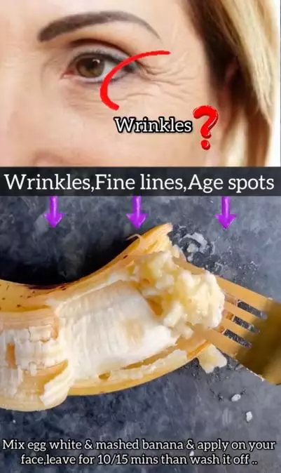 Pudarkan kerutan dan flek dengan tambahan 1 jenis buah Berbagai sumber