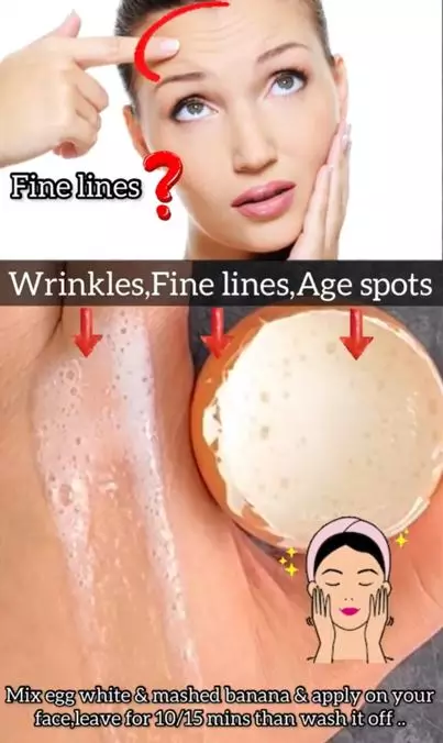 Pudarkan kerutan dan flek dengan tambahan 1 jenis buah Berbagai sumber