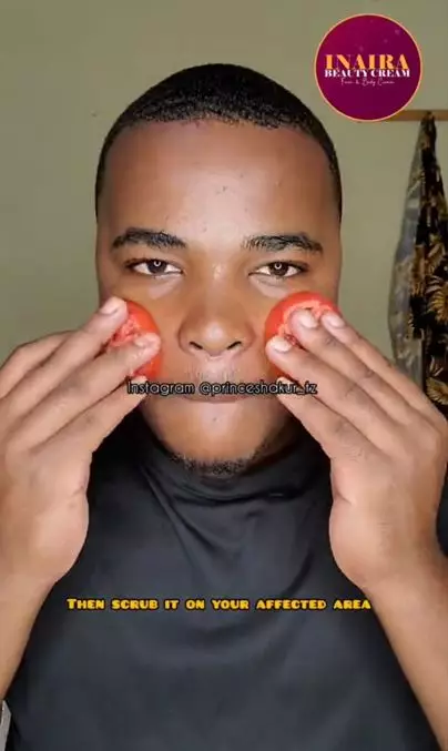 Hilangkan komedo pada pipi pakai 1 jenis buah-buahan Berbagai sumber