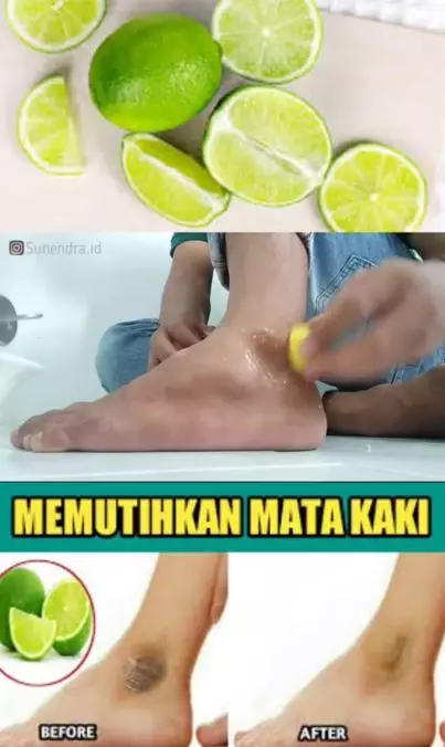Memutihkan mata kaki hitam dengan 1 jenis buah-buahan Berbagai sumber