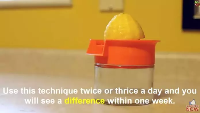 cara atasi jerawat saat masa kehamilan berbagai sumber