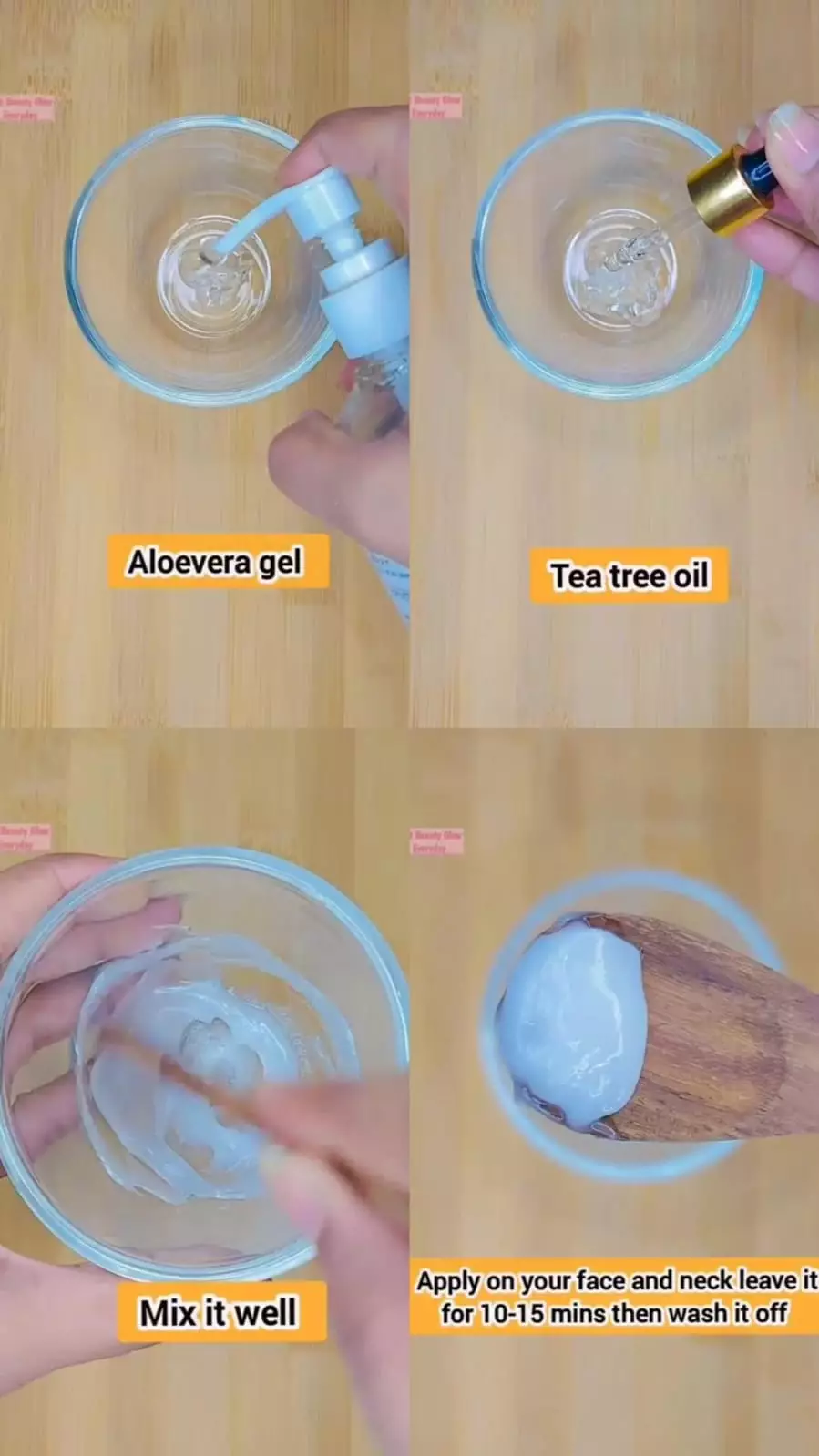 tuntaskan jerawat agar tak hilang-timbul © Instagram