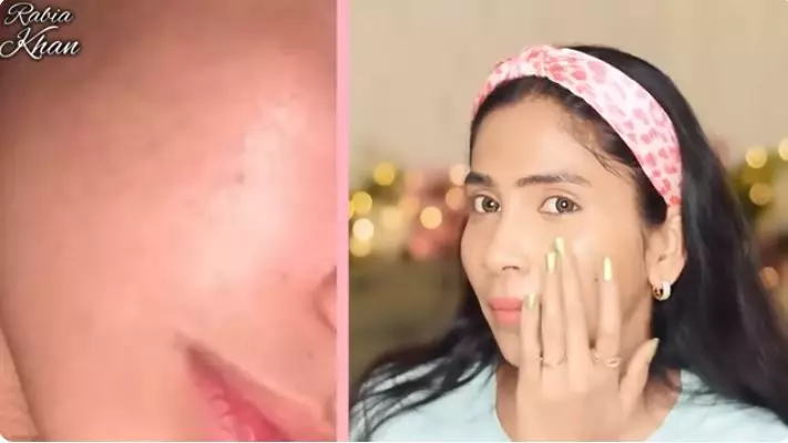 cara bikin wajah kembali tampak cerah berbagai sumber