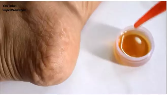 cara haluskan kembali tumit kaki retak berbagai sumber cara haluskan kembali tumit kaki retak berbagai sumber