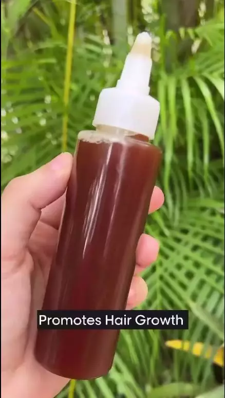 Rambut rontok karena penuaan berbagai sumber