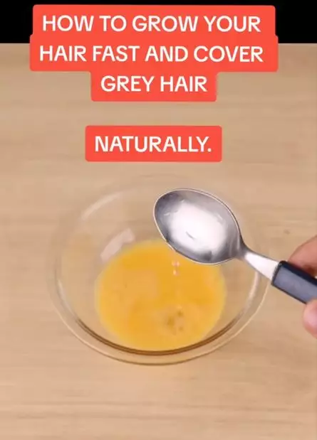 Atasi uban dan rambut sulit tumbuh pakai 1 jenis produk bayi  Berbagai sumber