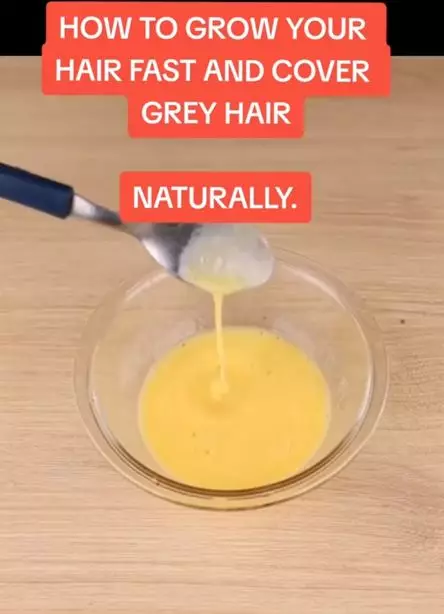 Atasi uban dan rambut sulit tumbuh pakai 1 jenis produk bayi  Berbagai sumber