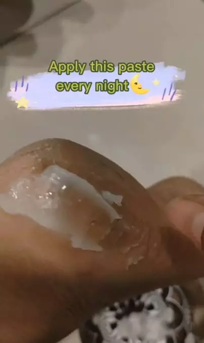 Haluskan kembali tumit pecah-pecah pakai 1 jenis minyak Berbagai sumber