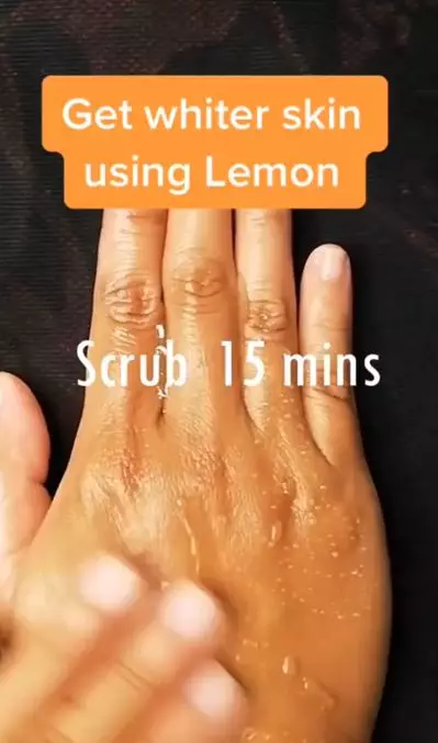 Memutihkan kulit belang dengan tambahan 2 bahan pemanis Berbagai sumber