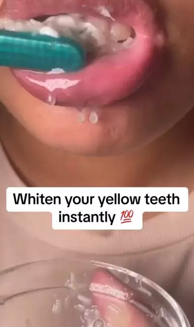 Hilangkan noda kuning pada gigi dengan 1 bumbu dapur Berbagai sumber Hilangkan noda kuning pada gigi dengan 1 bumbu dapur Berbagai sumber