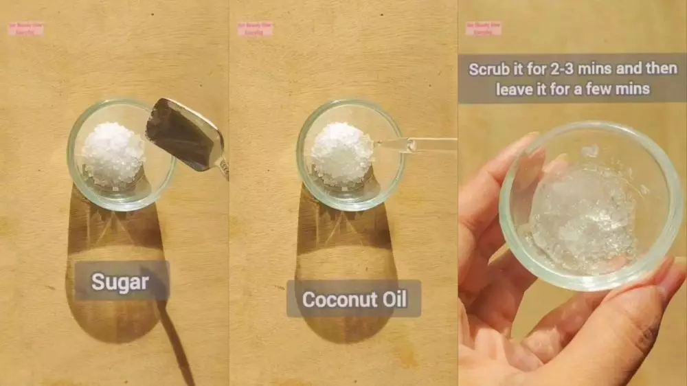 ketiak hitam dan berdaki © Instagram