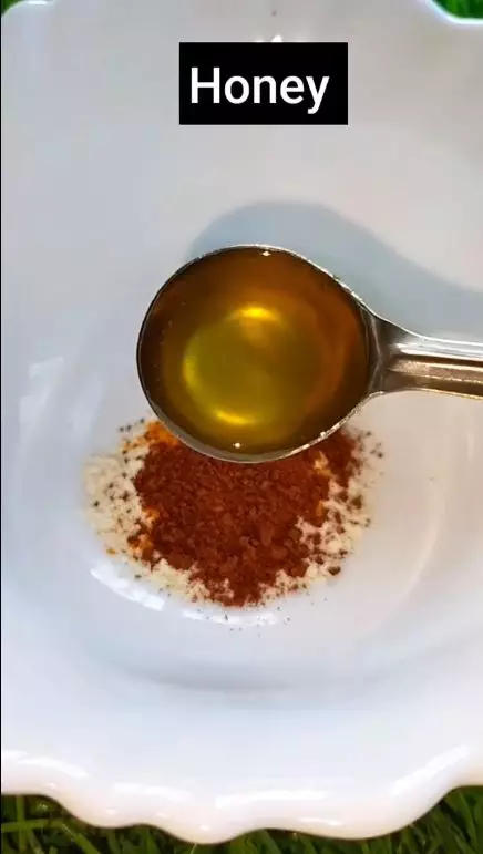 Trik hempaskan komedo di area dagu berbagai sumber