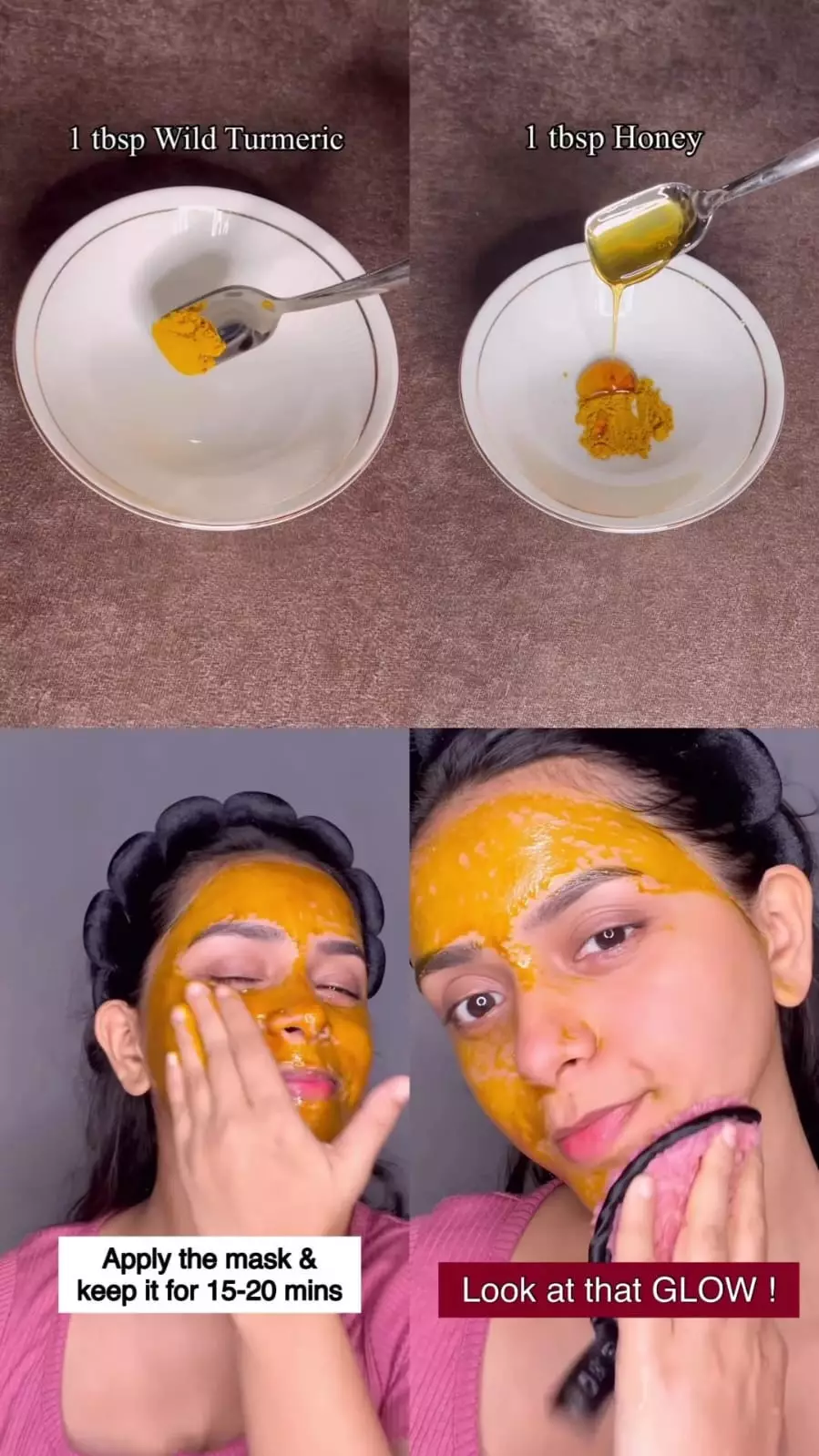 enyahkan jerawat © Instagram