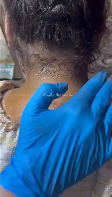 trik hilangkan garis halus dan noda hitam berbagai sumber