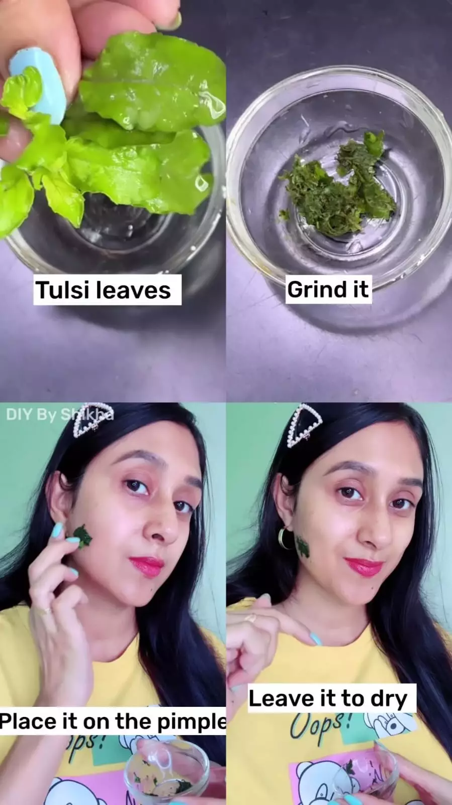 meradang dalam semalam © Instagram