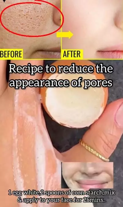 Kecilkan pori-pori wajah dengan tambahan 1 jenis tepung Berbagai sumber