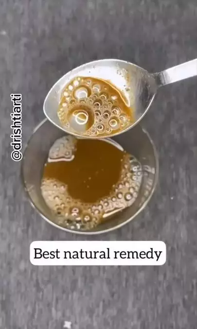 Cegah uban ala orang India pakai 1 bumbu dapur Berbagai sumber Cegah uban ala orang India pakai 1 bumbu dapur Berbagai sumber