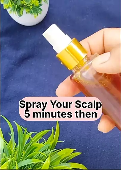 cara mencegah rambut rontok berbagai sumber